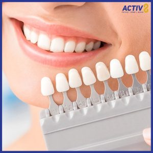 Alternative view of Teeth Whitening + Scaling